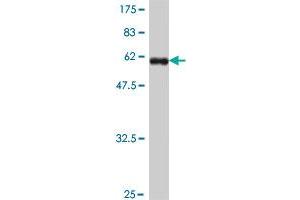 Western Blot detection against Immunogen (57. (CEBPE 抗体  (AA 1-281))