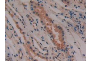 Immunohistochemistry (IHC) image for anti-Prostaglandin D2 Synthase (PTGDS) (AA 32-190) antibody (ABIN7432472)