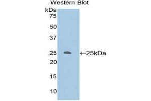 Western blot analysis of the recombinant protein. (PKC zeta 抗体  (AA 404-591))