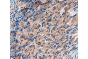 IHC-P analysis of stomach tissue, with DAB staining. (EPRS 抗体  (AA 1007-1512))