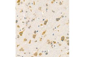 Immunohistochemistry of paraffin embedded rat brain using Rac3 (ABIN7075378) at dilution of 1:2000 (400x lens) (RAC3 抗体)