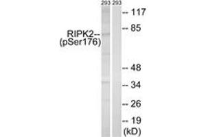 Western blot analysis of extracts from 293 cells treated with UV 15', using RIPK2 (Phospho-Ser176) Antibody. (RIPK2 抗体  (pSer176))
