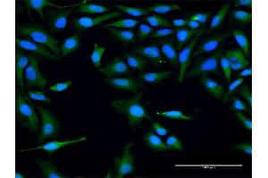 Immunofluorescence of purified MaxPab antibody to FLJ22662 on HeLa cell. (FLJ22662 (AA 1-223) 抗体)