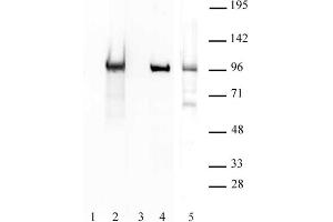 BORIS / CTCFL antibody (pAb) tested by Western blot. (CTCFL 抗体  (N-Term))