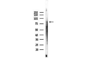 anti-Acyl-CoA Synthetase Short-Chain Family Member 2 (ACSS2) (N-Term) antibody