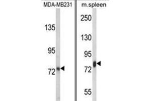 (LEFT) Western blot analysis of LTF Antibody in MDA-MB231 cell line lysates (35ug/lane). (Lactoferrin 抗体)