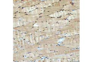 IHC analysis of ACSS2 using anti-ACSS2 antibody (ABIN7600569).