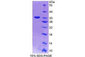 SDS-PAGE (SDS) image for Latent Transforming Growth Factor beta Binding Protein 2 (LTBP2) (AA 522-814) protein (His tag) (ABIN2125613)