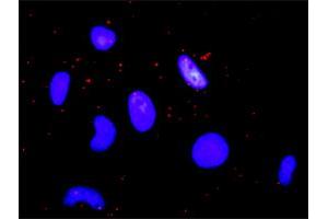 Proximity Ligation Analysis of protein-protein interactions between FGFR1 and CREBBP. (CBP 抗体  (AA 951-1050))