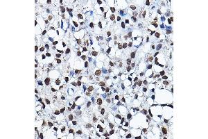 Immunohistochemistry (IHC) image for anti-MYST Histone Acetyltransferase 2 (MYST2) (AA 55-193) antibody (ABIN6142689)