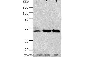 Western blot analysis of 293T and K562 cell, human fetal kidney tissue, using F2R Polyclonal Antibody at dilution of 1:650 (PAR1 抗体)