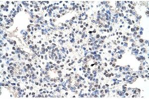 Rabbit Anti-NCL Antibody Catalog Number: ARP40583 Paraffin Embedded Tissue: Human Lung Cellular Data: Alveolar cells Antibody Concentration: 4. (Nucleolin 抗体  (N-Term))