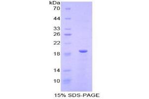 SDS-PAGE analysis of Mouse Relaxin Protein. (Relaxin 蛋白)