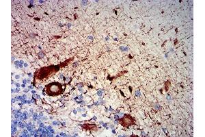Immunohistochemistry (IHC) image for anti-Neurofilament, Heavy Polypeptide (NEFH) (AA 2-251) antibody (ABIN7193620)