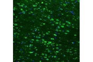 IF analysis of HSP90AB1 using anti-HSP90AB1 antibody (ABIN3042462) HSP90AB1 was detected in paraffin-embedded section of mouse brain tissues.