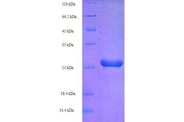 HPV16 E7 Protein (AA 1-99, full length) (His-SUMO Tag)