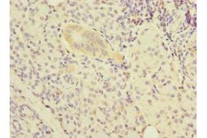 Immunohistochemistry of paraffin-embedded human pancreatic tissue using ABIN7161966 at dilution of 1:100 (Nucleolar Protein 1 (NOL1) (AA 1-210) 抗体)