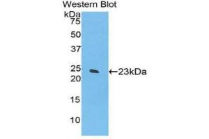 Western blot analysis of the recombinant protein. (SPTAN1 抗体  (AA 1950-2137))