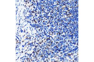Immunohistochemistry of paraffin-embedded mouse spleen using HuR/EL antibody (ABIN7266913) at dilution of 1:100 (40x lens). (ELAVL1 抗体)