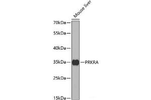Western blot analysis of extracts of Mouse liver using PRKRA Polyclonal Antibody at dilution of 1:1000. (PRKRA 抗体)