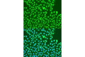 Immunofluorescence analysis of U2OS cells using Phospho-DNA-PKcs-S2056 antibody (ABIN6135292, ABIN6136206, ABIN6136207 and ABIN6225632) at dilution of 1:100. (PRKDC 抗体  (pSer2056))