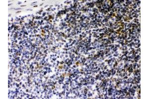 Immunohistochemistry (IHC) image for anti-Class II, Major Histocompatibility Complex, Transactivator (CIITA) (AA 945-1130) antibody (ABIN4886541)