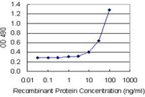 Sandwich ELISA detection sensitivity ranging from 10 ng/mL to 100 ng/mL. (TAGLN (人) Matched Antibody Pair)
