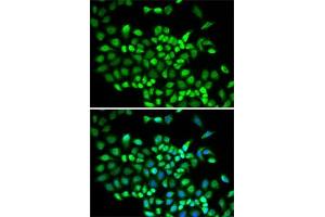 Immunofluorescence analysis of A-549 cells using Cullin 2 antibody (ABIN6129299, ABIN6139249, ABIN6139250 and ABIN6220930). (Cullin 2 抗体  (AA 40-310))