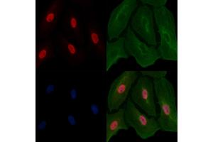 ABIN6261157 and ABIN6266615 staining  cells by IF/ICC.