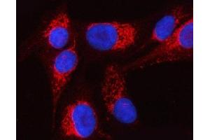 IF analysis of PTPIP51/RMDN3 using anti-PTPIP51/RMDN3 antibody (ABIN7601775).