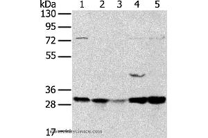 Western blot analysis of 293T and MCF7 cell, mouse brain tissue and K562 cell, mouse bladder tissue, using TPD52L2 Polyclonal Antibody at dilution of 1:400 (TPD52L2 抗体)