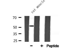 Western blot analysis of ARMC6 expression in Rat muscle lysate (ARMC6 抗体  (C-Term))