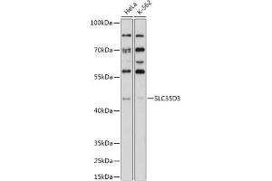 Western blot analysis of extracts of various cell lines, using SLC35D3 antibody (ABIN7270452) at 1:1000 dilution.