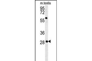 Western Blotting (WB) image for anti-Glutathione S-Transferase omega 2 (GSTO2) (AA 82-110) antibody (ABIN652022)