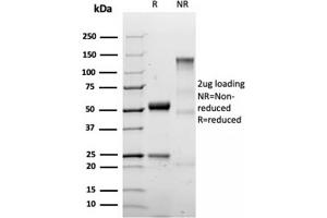 SDS-PAGE Analysis Purified S100B Recombinant Rabbit Monoclonal Antibody (S100B/1706R). (Recombinant S100B 抗体)