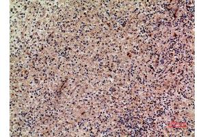 Immunohistochemistry (IHC) analysis of paraffin-embedded Human Liver, antibody was diluted at 1:100. (XCL1 抗体  (Internal Region))