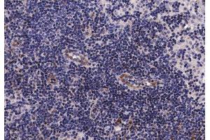 ABIN6267261 at 1/200 staining human lymph node tissue sections by IHC-P. (EGFR 抗体  (pSer1070))