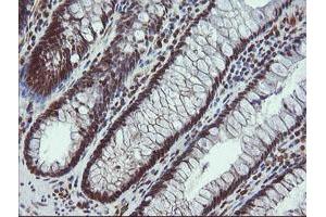 Immunohistochemistry (IHC) image for anti-ALX Homeobox 4 (ALX4) antibody (ABIN1496621) (ALX4 抗体)