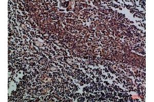 Immunohistochemical analysis of paraffin-embedded Human-tonsil, antibody was diluted at 1:100 (KIR2DL5A 抗体  (AA 31-80))