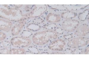 Detection of JAM2 in Human Kidney Tissue using Polyclonal Antibody to Junctional Adhesion Molecule 2 (JAM2) (JAM2 抗体  (AA 74-250))