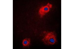 Immunofluorescent analysis of GSK3 alpha (pS21) staining in PC12 cells. (GSK3 alpha 抗体  (N-Term, pSer21))