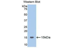 Western blot analysis of the recombinant protein. (GNRH1 抗体  (AA 24-92))