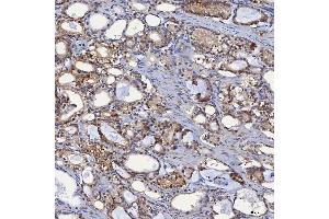 IHC analysis of SBP/SELENBP1 using anti-SBP/SELENBP1 antibody (ABIN7600755). (SELENBP1 抗体  (AA 23-462))