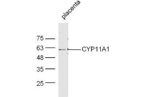 Mouse placenta lysates probed with Rabbit Anti-CYP11A1 Polyclonal Antibody, Unconjugated  at 1:500 for 90 min at 37˚C. (CYP11A1 抗体  (AA 321-420))