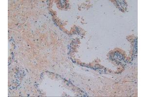 IHC-P analysis of Human Prostate Gland Tissue, with DAB staining. (Vitamin D-Binding Protein 抗体  (AA 209-401))