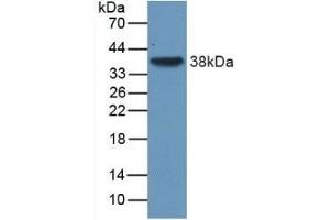 Detection of Recombinant TGFb3, Human using Monoclonal Antibody to Transforming Growth Factor Beta 3 (TGFb3) (TGFB3 抗体  (AA 24-300))