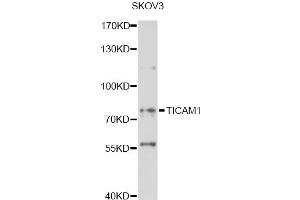 Western blot analysis of extracts of SKOV3 cells, using TICAM1 antibody (ABIN6292307) at 1:1000 dilution. (TICAM1 抗体)