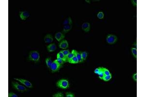 Immunofluorescent analysis of MCF-7 cells using ABIN7175630 at dilution of 1:100 and Alexa Fluor 488-congugated AffiniPure Goat Anti-Rabbit IgG(H+L) (VN1R2 抗体  (AA 115-170))