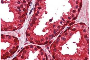 Immunohistochemistry (IHC) image for anti-Enolase 1 (ENO1) (AA 246-295) antibody (ABIN6748542)
