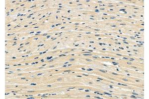 ABIN6265329 and ABIN6273169 at 1/100 staining Rat heart tissue by IHC-P. (STAU1/Staufen 抗体  (Internal Region))